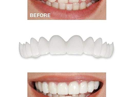 stores-that-sell-cosmetic-teeth