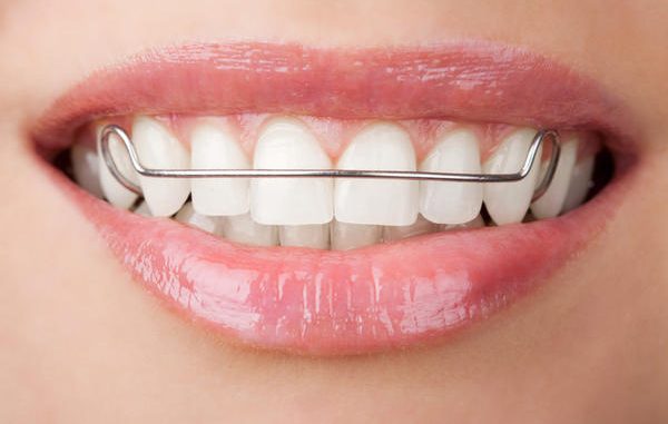 teeth-plates