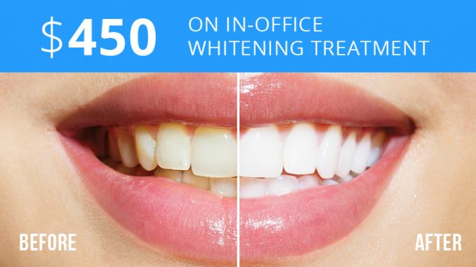 Teeth Dentist Whitening Costs