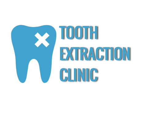 tooth-extraction-clinics
