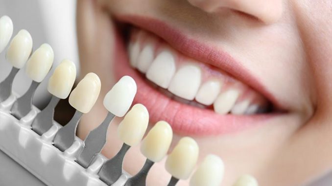 tooth-replacement