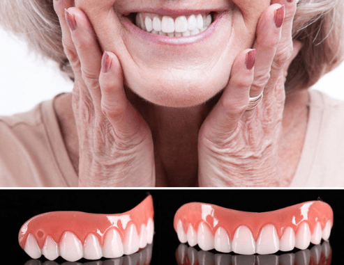 veneers-deals