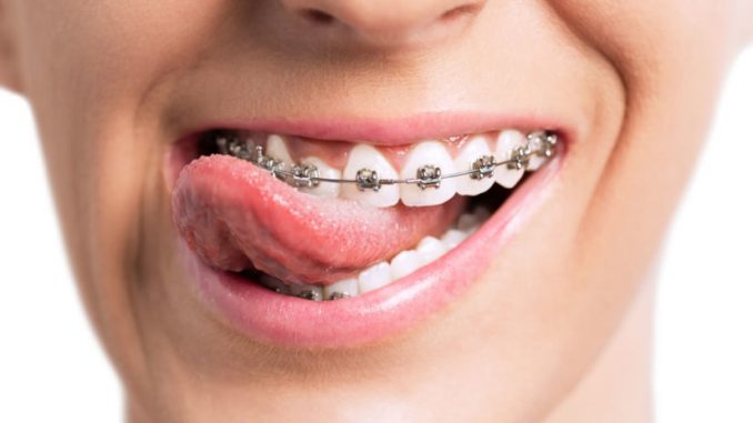 braces-doctor-called