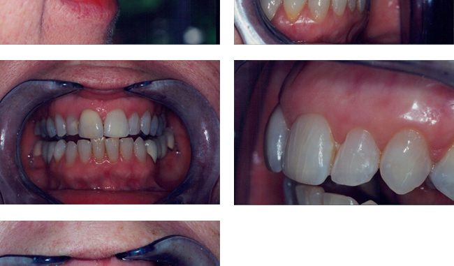 cosmetic-dentistry-atlanta