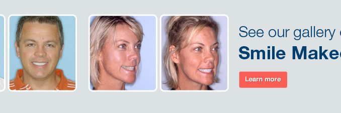 cosmetic-dentistry-cincinnati
