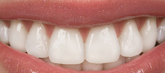 cosmetic-dentistry-memphis