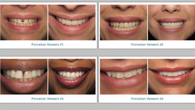 cosmetic-dentistry-orange-county