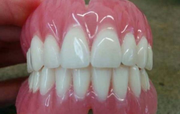 dentchers