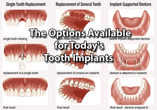 dentistry-options
