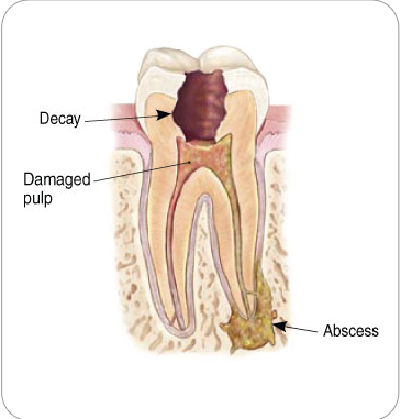 endodontist-definition