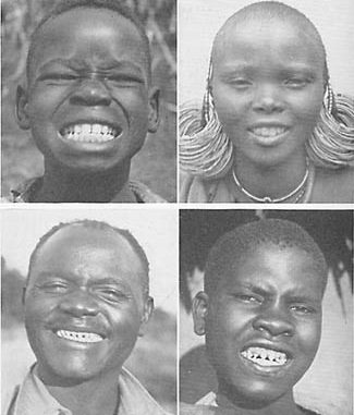 filing-teeth-at-home