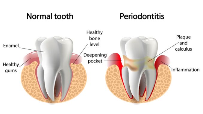 gum-specialist-dentist