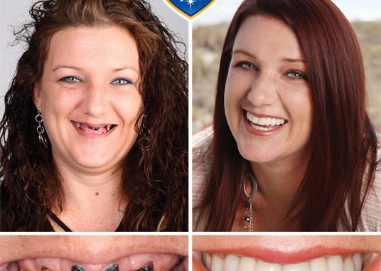 how-to-get-a-free-dental-makeover