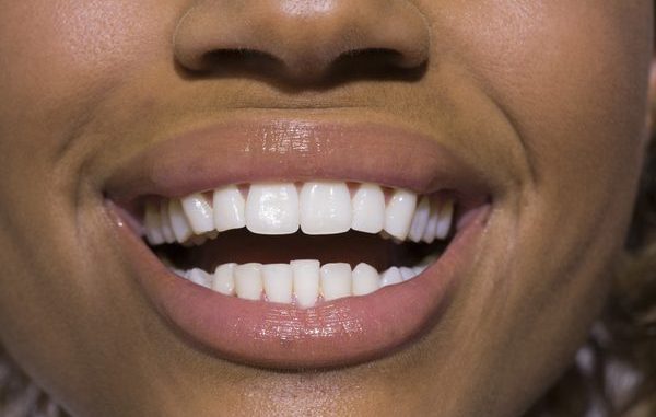make-your-own-tooth