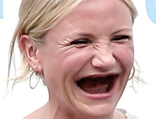people-with-no-teeth