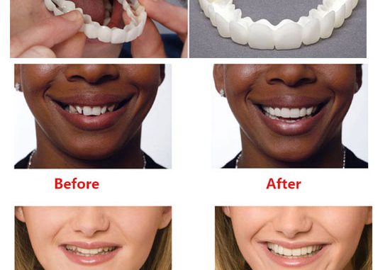 realistic-fake-teeth