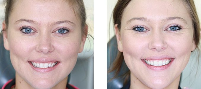 teeth-plastic-surgery