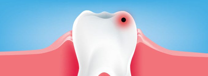 what-dental