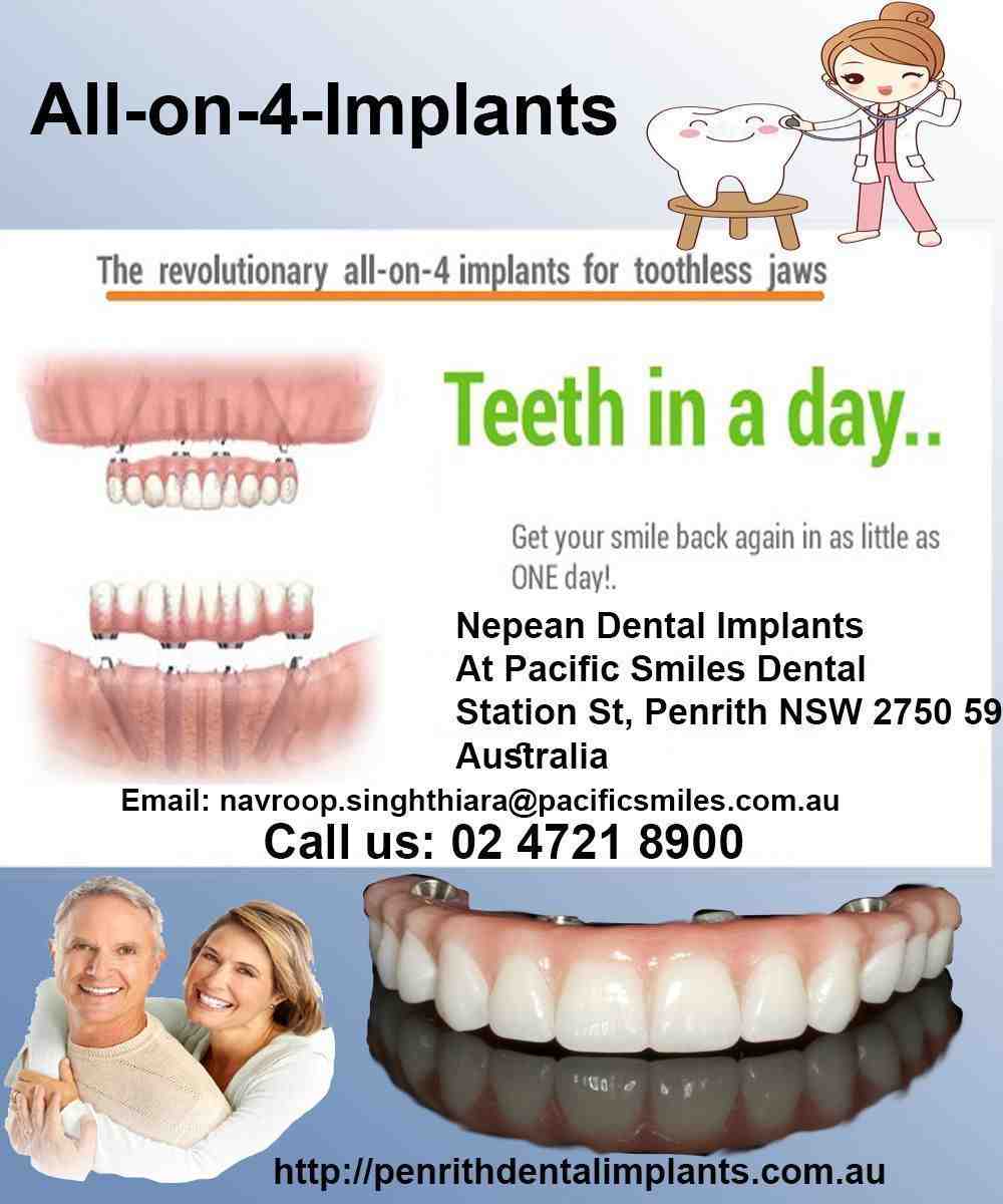 Are dental implants overpriced?