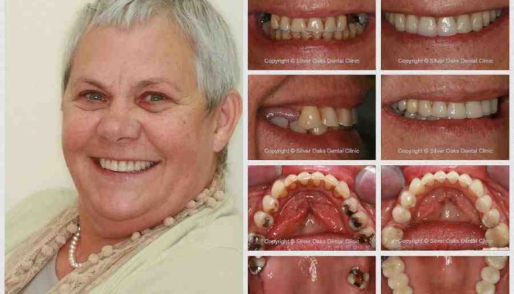 Are dental implants painful