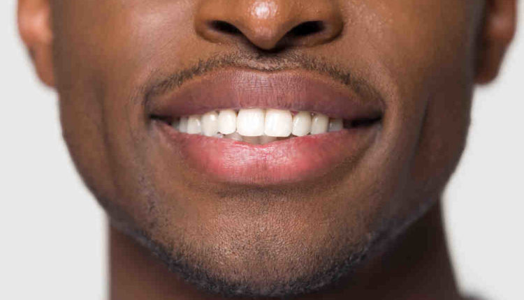 Are dental implants safe