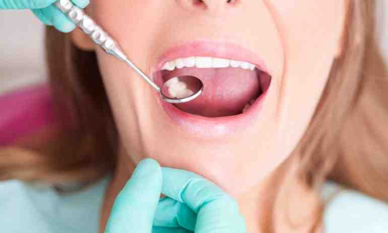 Can I get dental financing with bad credit?