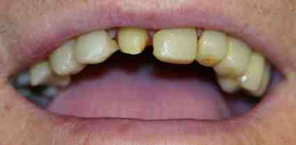 Can you get cosmetic dentistry on the NHS?