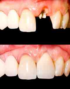 Can you get cosmetic dentistry on the NHS?