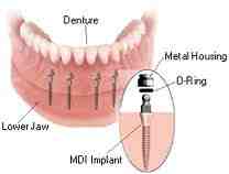 Can you get cosmetic dentistry on the NHS?