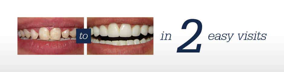 Can you get cosmetic dentistry on the NHS?