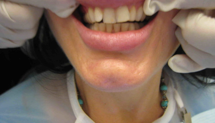 Cosmetic dentistry 85021 inhouse payment options