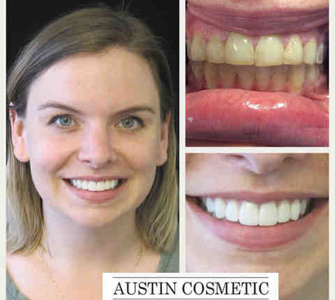 Cosmetic dentistry austin, texas