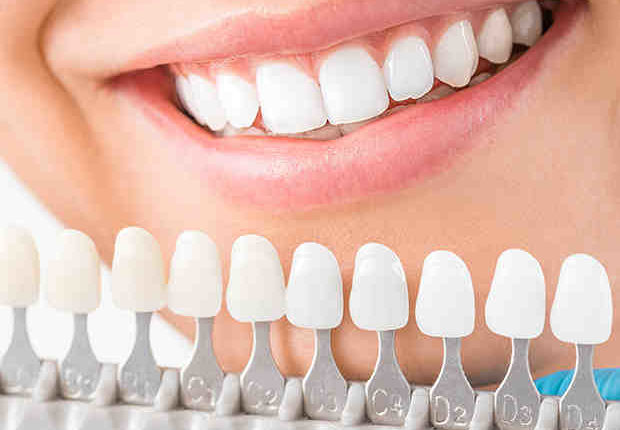Cosmetic dentistry ballwin