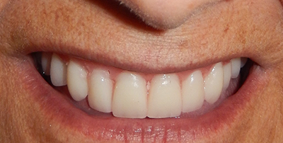 Do NHS dentists do cosmetic work?