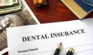 Does any insurance cover dental implants?