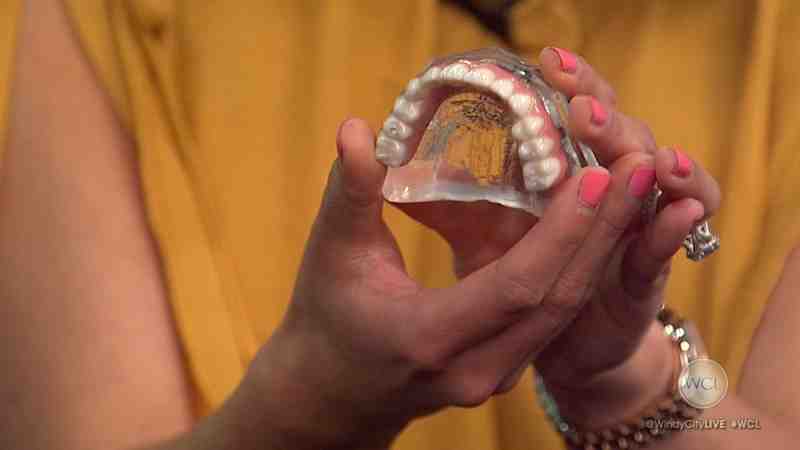 Does clear choice really do implants in one day?