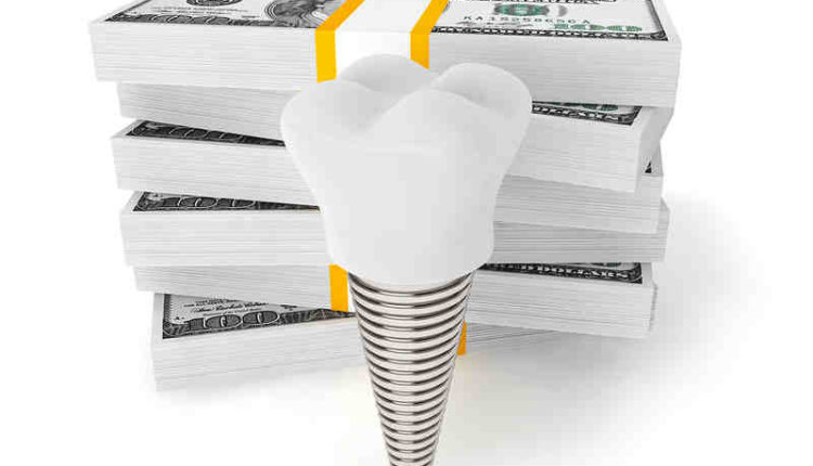 Does dental insurance cover implants
