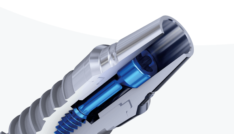 Does medi-cal cover dental implants