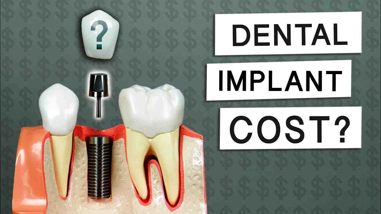 does-medicare-cover-dental-implants-dental-news-network