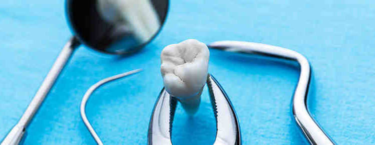Does Physicians Mutual Cover Dental Implants » Dental News Network