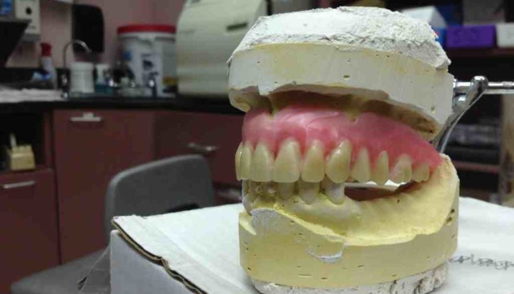 Does western dental do implants