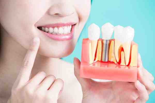 How Much Does a full dental makeover cost?