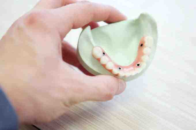 How can I get dental implants covered by insurance?