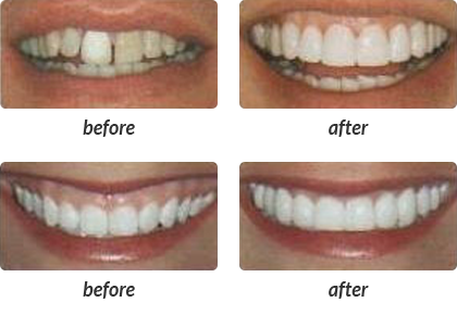 How do I find the best cosmetic dentist in my area?