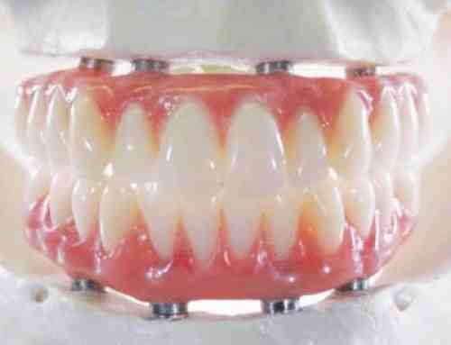 How do you finance cosmetic dentistry?