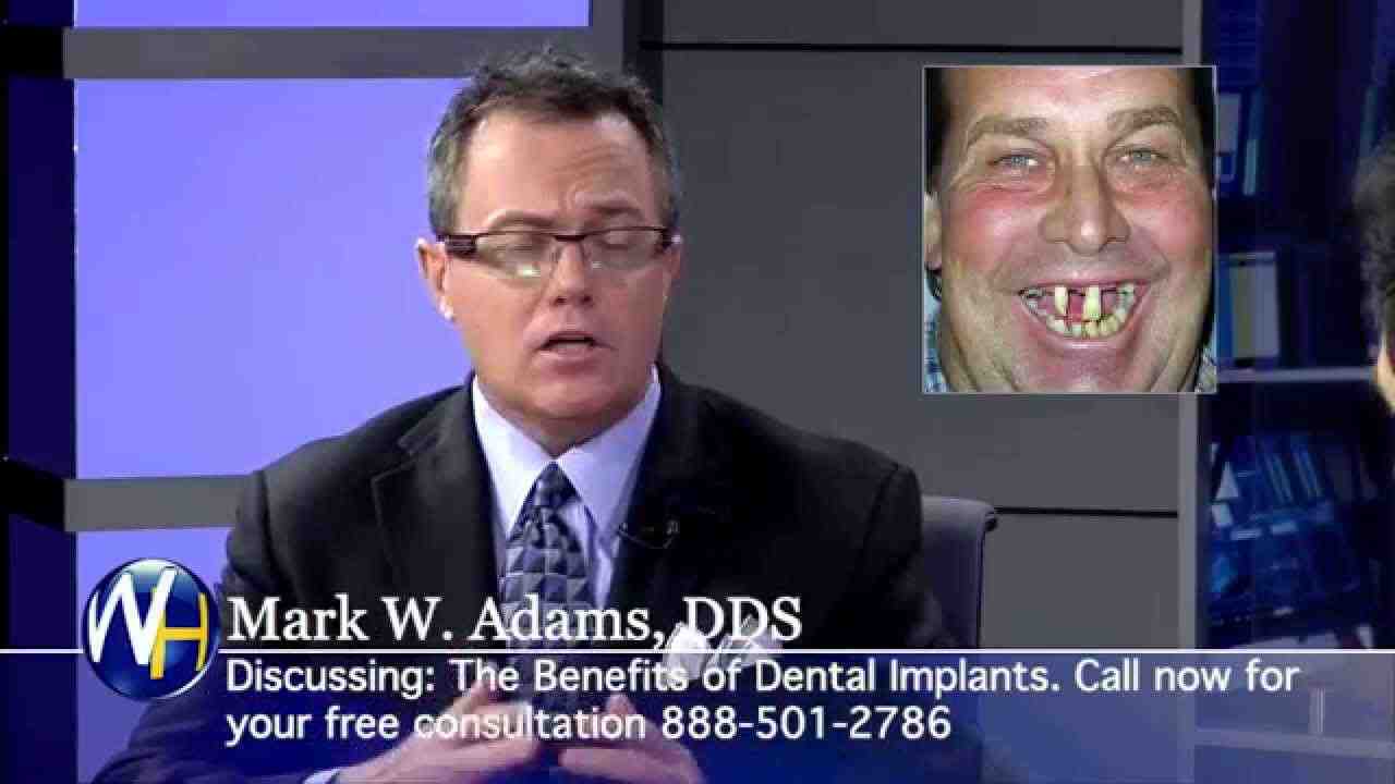 How Much Are Clear Choice Dental Implants Dental News Network