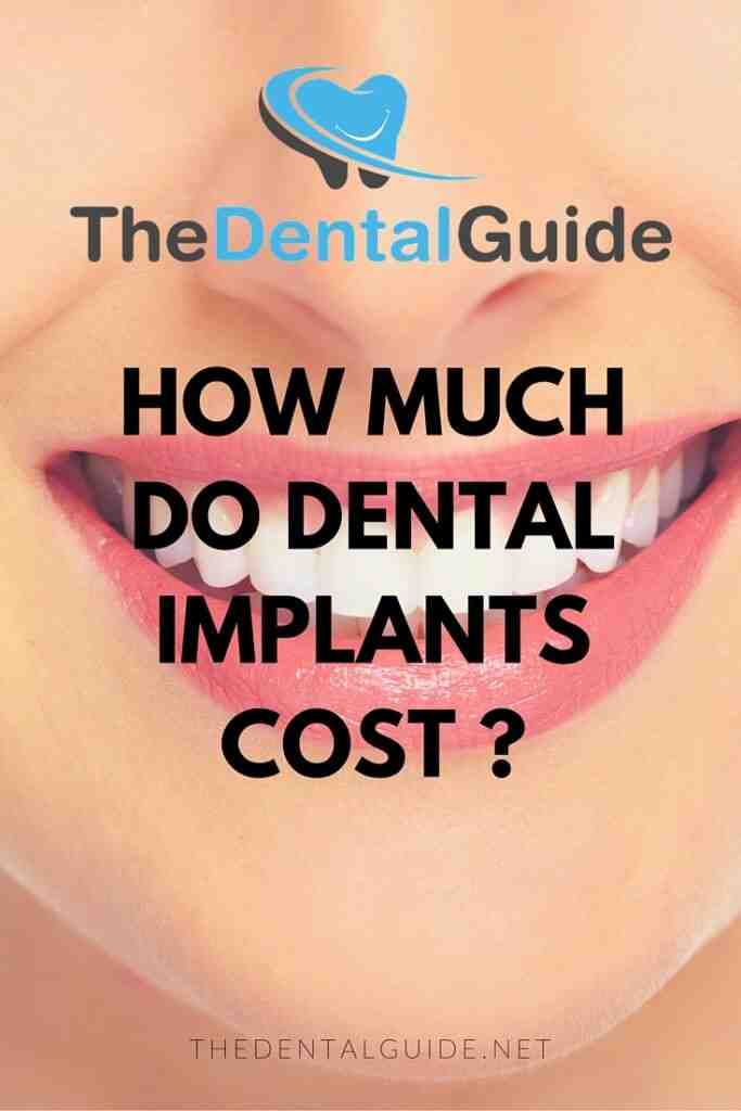 How much do dental implants cost in 2020?