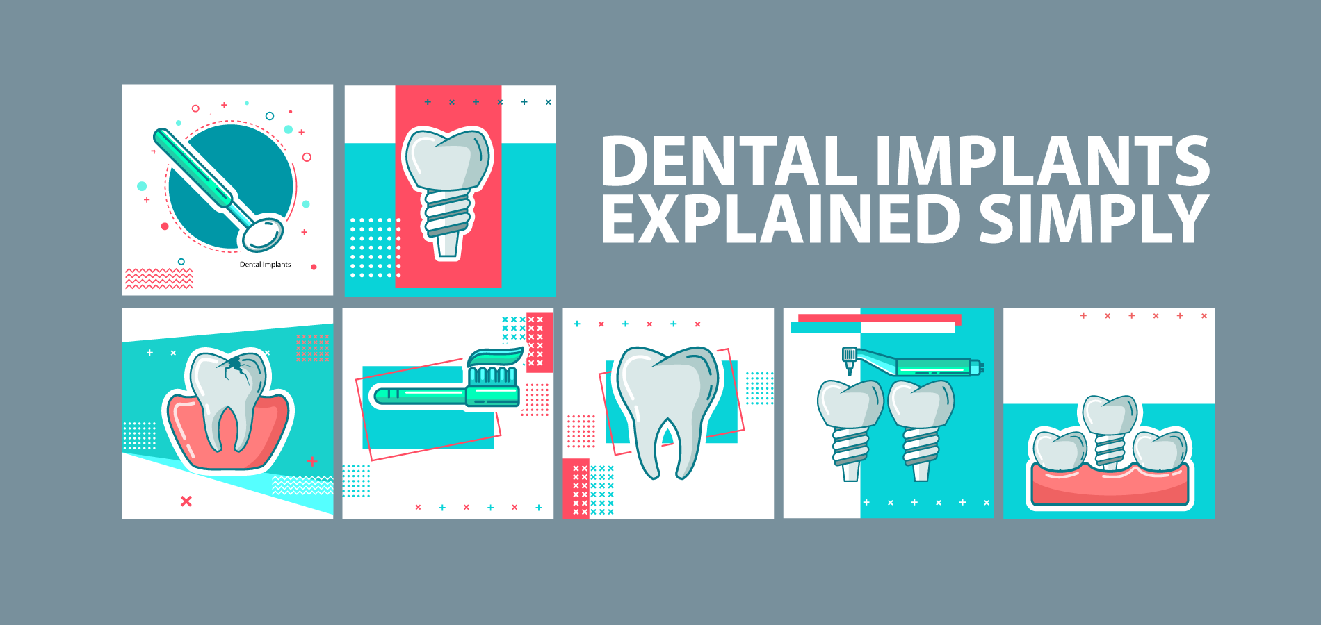 How much do dental implants cost in 2020?