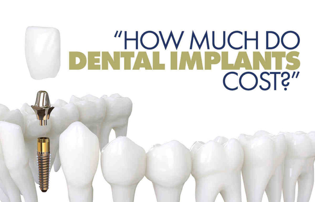 What Does A Dental Implant Cost Dental News Network   How Much Do Dental Implants Cost In Australia 1 1024x655 