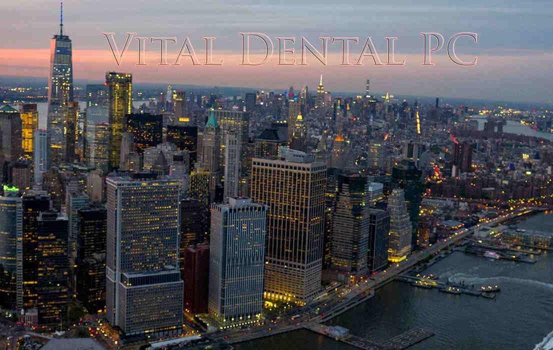 How much do veneers cost in NY?